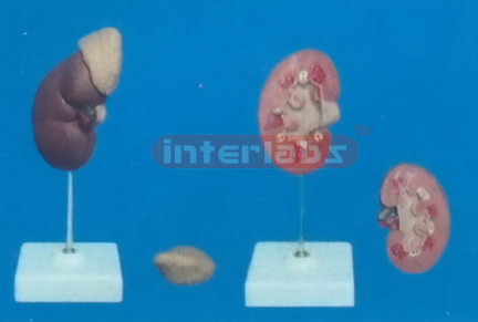 NATURAL RIGHT KIDNEY WITH REMOVABLE ADRENAL GLAND 3 PCS 8.5 CM LONG